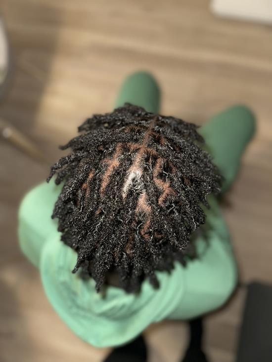 Interloc Simple (100 locs et plus)